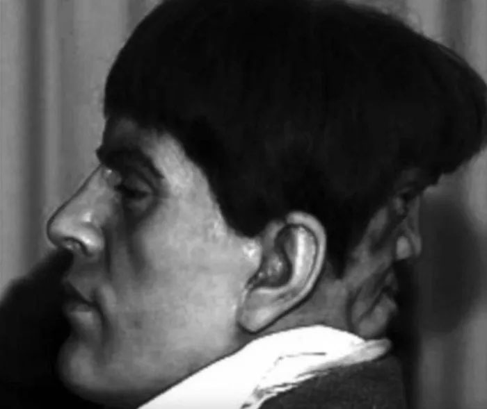 Tượng sáp mô phỏng hình ảnh của Edward Mordrake.