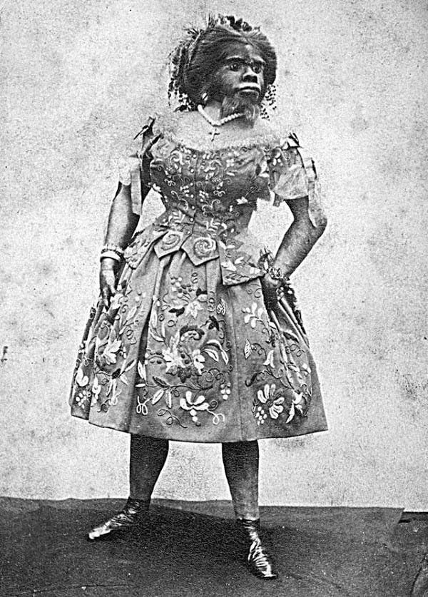Julia Pastrana Sự thật về "người phụ nữ lai gấu"