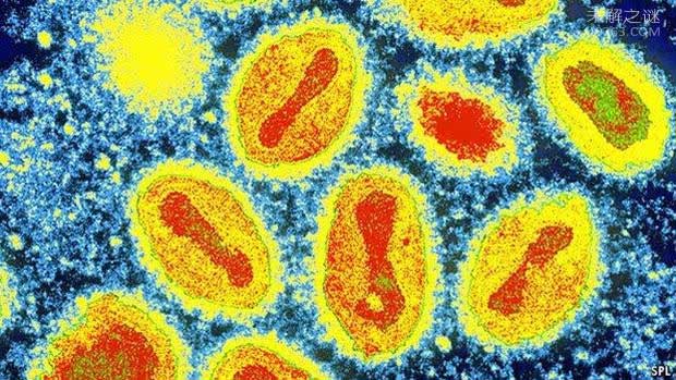 virus-dau-mua Virus đậu mùa
