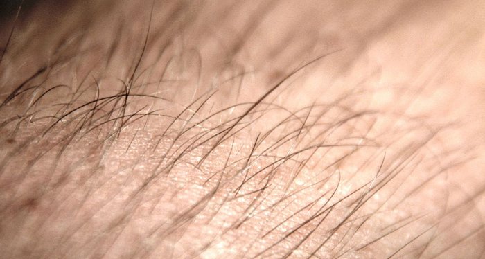 Lông tóc vẫn mọc sau khi chết? Lông tóc vẫn mọc sau khi chết?