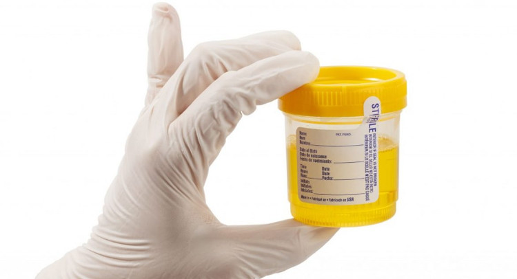Glucose là dấu hiệu hay gặp ở bệnh nhân tiểu đường. Glucose là dấu hiệu hay gặp ở bệnh nhân tiểu đường.