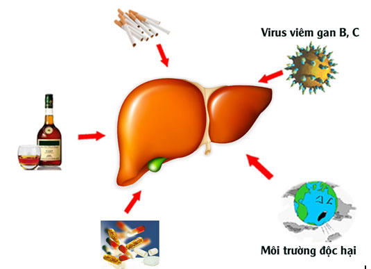xo-gan-1 Các nguyên nhân gây bệnh xơ gan